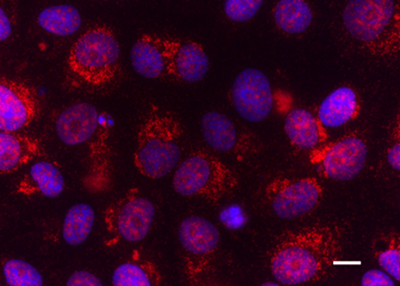 Immunofluorescence microscopy of DENV-4 (dengue) infection in Vero E6 cells